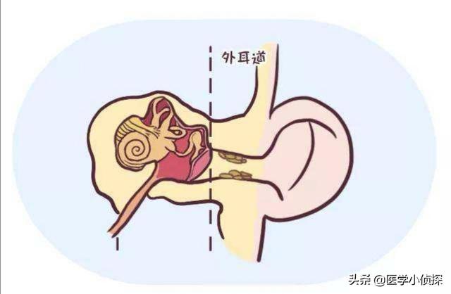 耳朵里面总是痒是怎么回事strong/p/p
p戴耳环后耳洞流水样
/strong？